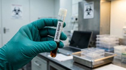 Ebola: autosegnalazione per chi proviene da Congo e Uganda